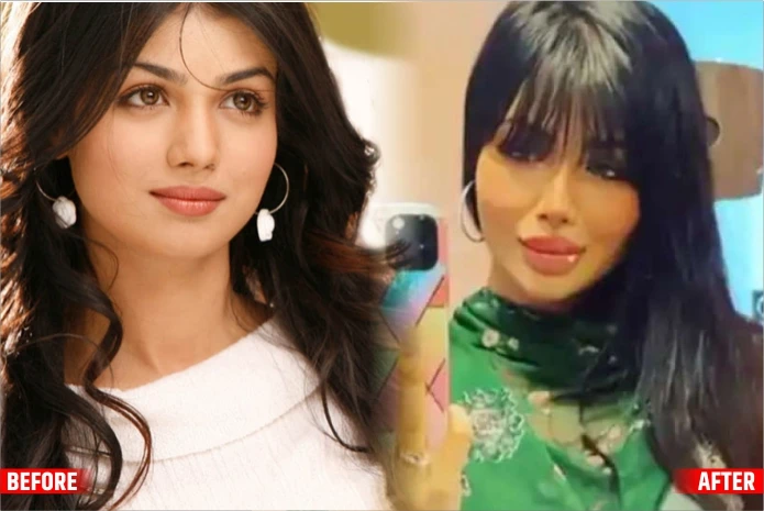Ayesha The Btown Actresses Before and After Plastic Surgery