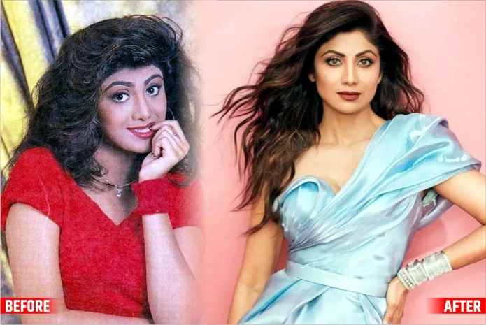 Shilpa Shetty The Btown Actresses Before and After Plastic Surgery