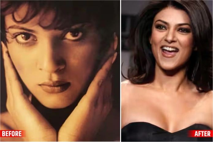 Sushmita Sen The Btown Actresses Before and After Plastic Surgery