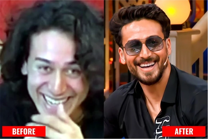 Tiger Shroff: Bollywood celebrity teeth before and after